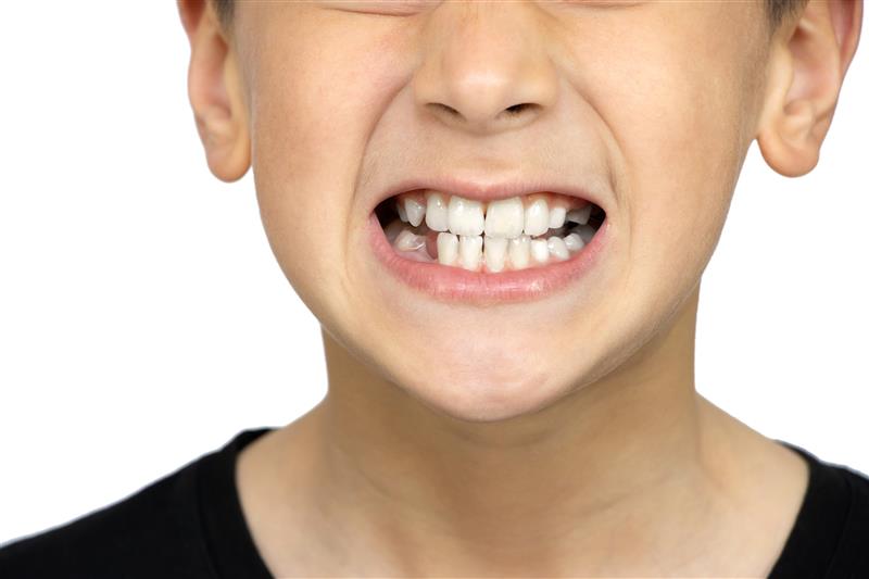 Bruxism